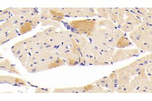 Detection of CGRP in Mouse Cardiac Muscle Tissue using Polyclonal Antibody to Calcitonin Gene Related Peptide (CGRP)