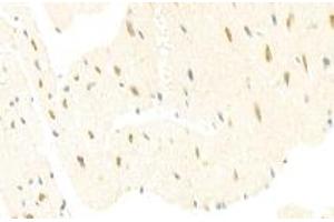 Immunohistochemistry analysis of paraffin-embedded mouse heart using mSin3A (ABIN7075609) at dilution of 1: 100 (SIN3A antibody)