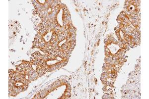 IHC-P Image Immunohistochemical analysis of paraffin-embedded human endo mitrial, using CCNDBP1, antibody at 1:100 dilution. (CCNDBP1 antibody  (C-Term))