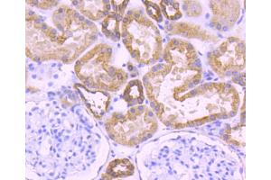 Immunohistochemistry (Paraffin-embedded Sections) (IHC (p)) image for anti-Keratin 18 (KRT18) antibody (ABIN5557298)