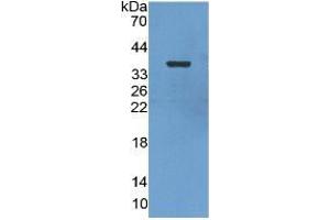 WB of Protein Standard: different control antibodies  against Highly purified E. (ENO2/NSE ELISA Kit)