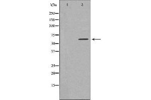 Western blot analysis of extracts from HeLa cells, using TBC1D3 antibody. (TBC1D3 antibody)