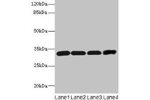 Western blot All lanes: Ms4a1 antibody at 4 μg/mL Lane 1: Hela whole cell lysate Lane 2: Jurkat whole cell lysate Lane 3: 293T whole cell lysate Lane 4: HL60 whole cell lysate Secondary Goat polyclonal to rabbit IgG at 1/10000 dilution Predicted band size: 32 kDa Observed band size: 32 kDa (CD20 antibody  (AA 111-291))
