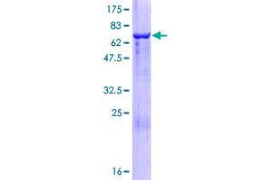 Image no. 1 for Cytohesin 3 (CYTH3) (AA 1-399) protein (GST tag) (ABIN1351042) (Cytohesin 3 Protein (CYTH3) (AA 1-399) (GST tag))