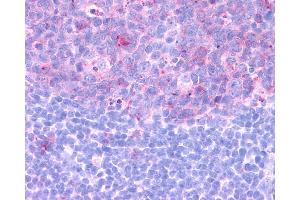 Anti-CCR3 antibody IHC of human tonsil. (CCR3 antibody  (Extracellular Domain))