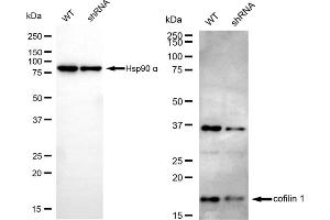 Western blotting analysis using cofilin 1 antibody (ABIN7798111). (Recombinant Cofilin antibody)