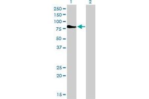 Western Blot analysis of DMPK expression in transfected 293T cell line by DMPK monoclonal antibody (M01), clone 2F7. (DMPK antibody  (AA 303-420))