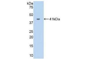 Detection of Recombinant VCC1, Human using Polyclonal Antibody to VEGF Co Regulated Chemokine 1 (VCC1) (CXCL17 antibody  (AA 24-119))