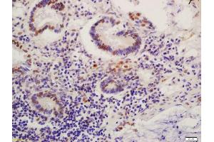 Immunohistochemistry (IHC) image for anti-Mdm2, p53 E3 Ubiquitin Protein Ligase Homolog (Mouse) (MDM2) (pSer186) antibody (ABIN802548)