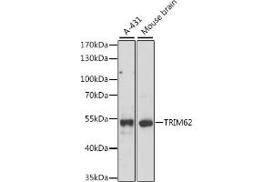 Western blot analysis of extracts of various cell lines, using TRIM62 antibody (ABIN7270996) at 1:1000 dilution. (TRIM62 antibody  (AA 120-280))
