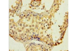 Immunohistochemistry of paraffin-embedded human testis tissue using ABIN7152513 at dilution of 1:100 (SUPT16H antibody  (AA 187-282))