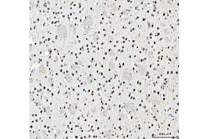 IHC analysis of SFPQ using anti-SFPQ antibody (ABIN7603089).