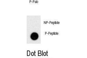 Dot blot analysis of anti-Phospho-PRL-p Antibody (ABIN389956 and ABIN2839758) on nitrocellulose membrane. (Prolactin antibody  (pSer163))