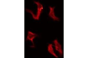 ABIN6276146 staining COLO205 by IF/ICC. (OR4A16 antibody  (C-Term))