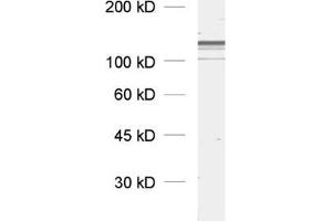 dilution: 1 : 1000, sample: rat brain homogenate (Dynamin 3 antibody  (AA 773-794))