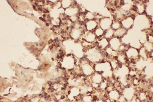 Anti-Cofilin Picoband antibody,  IHC(P): Mouse Lung Tissue (Cofilin antibody  (AA 2-166))