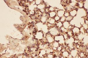 Anti-Cofilin Picoband antibody,  IHC(P): Mouse Lung Tissue