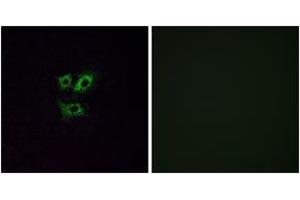 Immunofluorescence analysis of A549 cells, using OR2Y1 Antibody.