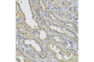 Immunohistochemistry of paraffin-embedded human kidney using PPID Antibody. (PPID antibody  (AA 161-370))