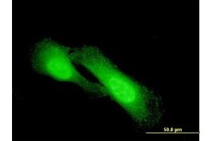 Immunofluorescence (IF) image for anti-N-Myc Downstream Regulated 1 (NDRG1) (AA 1-394) antibody (ABIN564518)