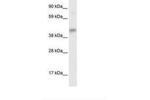 Image no. 1 for anti-SEC14-Like 2 (SEC14L2) (AA 245-294) antibody (ABIN6735907) (SEC14L2 antibody  (AA 245-294))