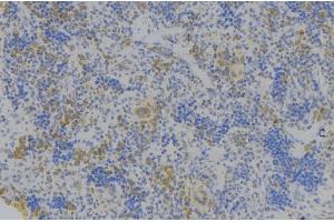 ABIN6278119 at 1/100 staining Human lymph node tissue by IHC-P. (GPA33 antibody  (Internal Region))