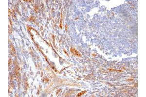 Formalin-fixed, paraffin-embedded human Tonsil stained with CD31 Mouse Monoclonal Antibody (C31. (CD31 antibody)