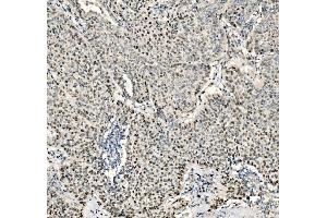 IHC analysis of JUNB using anti-JUNB antibody (ABIN7603223).