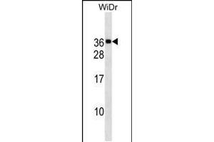 Western blot analysis in WiDr cell line lysates (35ug/lane). (MED30 antibody  (AA 107-133))