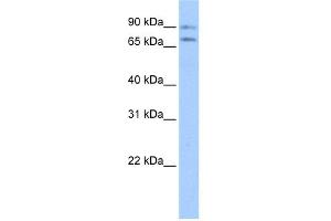 WB Suggested Anti-JPH2 Antibody Titration:  0. (Junctophilin 2 antibody  (Middle Region))