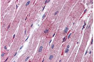 Human Heart: Formalin-Fixed, Paraffin-Embedded (FFPE) (MYL9 antibody  (C-Term))