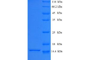 Surfactant Associated 3 (SFTA3) (AA 1-94), (full length) protein (His tag)