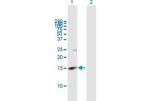 Western Blot analysis of RHBDL2 expression in transfected 293T cell line by RHBDL2 MaxPab polyclonal antibody.