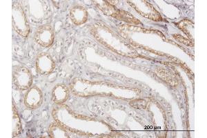 Immunoperoxidase of monoclonal antibody to CTSK on formalin-fixed paraffin-embedded human kidney. (Cathepsin K antibody  (AA 220-329))