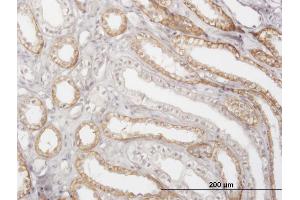 Immunoperoxidase of monoclonal antibody to CTSK on formalin-fixed paraffin-embedded human kidney.