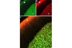 Immunohistochemistry (IHC) image for anti-Calcium Channel, Voltage-Dependent, L Type, alpha 1C Subunit (CACNA1C) (AA 848-865), (Intracellular) antibody (ABIN7043000)