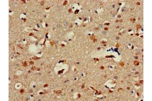 Immunohistochemistry of paraffin-embedded human brain tissue using ABIN7143961 at dilution of 1:100 (ALX1 antibody  (AA 10-304))