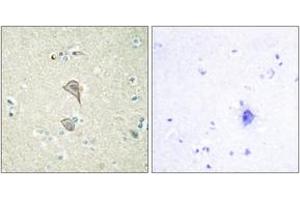 Immunohistochemistry analysis of paraffin-embedded human brain tissue, using NKTR Antibody. (NKTR antibody  (AA 784-833))