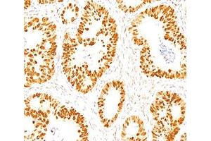 IHC staining of normal colon with p53 antibody (DO-7). (p53 antibody  (AA 20-25))