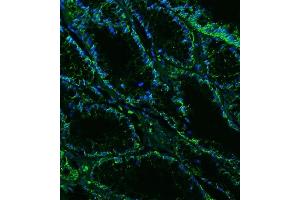 IF analysis of Claudin18/CLDN18 using anti-Claudin18/CLDN18 antibody (ABIN7601257). (Claudin 18 antibody  (AA 31-261))