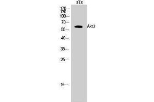 Western Blotting (WB) image for anti-V-Akt Murine Thymoma Viral Oncogene Homolog 2 (AKT2) (Ser138) antibody (ABIN3183243) (AKT2 antibody  (Ser138))