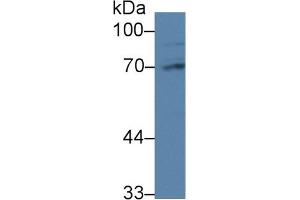 Detection of PABPC1L in Rat Liver lysate using Polyclonal Antibody to Poly A Binding Protein Cytoplasmic 1 Like Protein (PABPC1L) (PABPC1L antibody  (AA 514-612))