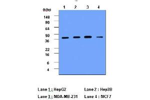 Western Blotting (WB) image for anti-Cathepsin D (CTSD) (AA 21-412) antibody (ABIN317502) (Cathepsin D antibody  (AA 21-412))