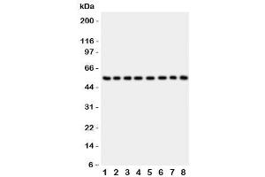 Western blot testing of P2X2 antibody and Lane 1:  rat brain (P2RX2 antibody  (AA 139-471))