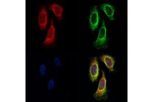 ABIN6257718 and ABIN6275927 staining Hela cells by IF/ICC. (CysLTR1 antibody  (Internal Region))