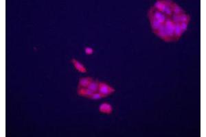 Immunofluorecence staining of GPC3 polyclonal antibody  on HepG2 cells . (Glypican 3 antibody  (AA 530-560))