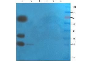 Western Blot using anti-SNAP25 antibody ABIN7072250 Mouse brain (lane 1), mouse rectum (lane 2), mouse pancreas (lane 3), human lung cancer (lane 4), human breast cancer (lane 5) and Hela cell(lane 6) samples were resolved on a 12 % SDS PAGE gel and blots probed with ABIN7072250 at 2 μg/mL before being detected by a secondary antibody. (Recombinant SNAP25 antibody)