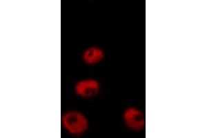 Immunofluorescence (fixed cells) (IF/ICC) image for anti-Checkpoint Kinase 2 (CHEK2) (pSer516) antibody (ABIN6255391)