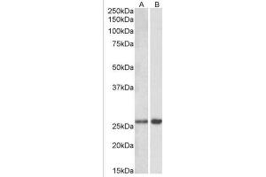 Staining of Mouse Brain lysate (A) and (1µg/ml) staining of Rat Brain lysate (B) using MOBKL3 antibody at 0. (MOBKL3 antibody  (Internal Region))