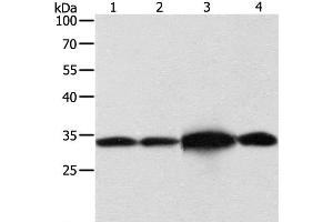 Western Blot analysis of Hela and Jurkat cell, Mouse brain tissue and 293T cell using NAPA Polyclonal Antibody at dilution of 1:500 (NAPA antibody)